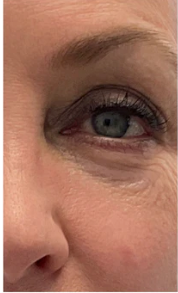 Before - Michelle T.